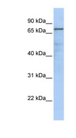 GMPS / GMP Synthase Antibody - GMPS antibody Western blot of MCF7 cell lysate. This image was taken for the unconjugated form of this product. Other forms have not been tested.