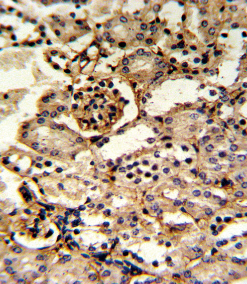 GMPS / GMP Synthase Antibody - Formalin-fixed and paraffin-embedded kidney tissue reacted with GMPS Antibody , which was peroxidase-conjugated to the secondary antibody, followed by DAB staining. This data demonstrates the use of this antibody for immunohistochemistry; clinical relevance has not been evaluated.
