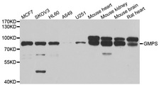 GMPS / GMP Synthase Antibody - Western blot analysis of extracts of various cell lines.