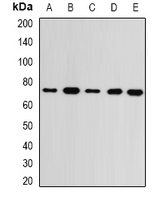 GMPS / GMP Synthase Antibody - Western blot analysis of GMPS expression in MCF7 (A); SKOV3 (B); mouse kidney (C); mouse brain (D); rat heart (E) whole cell lysates.