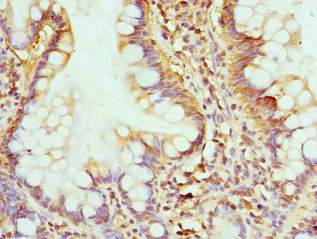GMPS / GMP Synthase Antibody - Immunohistochemistry of paraffin-embedded human small intestine at dilution 1:100
