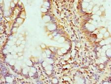GMPS / GMP Synthase Antibody - Immunohistochemistry of paraffin-embedded human small intestine at dilution 1:100