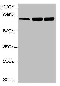 GMPS / GMP Synthase Antibody - Western blot All lanes: GMPS antibody at 2.69µg/ml Lane 1: Hela whole cell lysate Lane 2: HL60 whole cell lysate Lane 3: MCF-7 whole cell lysate Secondary Goat polyclonal to rabbit IgG at 1/10000 dilution Predicted band size: 77, 66 kDa Observed band size: 77 kDa