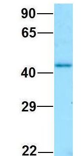 GNA11 Antibody - GNA11 antibody Western Blot of Human Fetal Kidney. Antibody Dilution: 1.0ug/ml. Antibody dilution: 1 ug/ml.  This image was taken for the unconjugated form of this product. Other forms have not been tested.