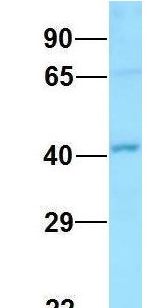 GNA11 Antibody - GNA11 antibody Western Blot of HeLa lysate. Antibody Dilution: 1.0ug/ml. There is BioGPS gene expression data showing that GNA11 is expressed in HeLa. Antibody dilution: 1 ug/ml.  This image was taken for the unconjugated form of this product. Other forms have not been tested.