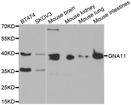 GNA11 Antibody - Western blot analysis of extracts of various cell lines, using GNA11 antibody.