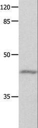 GNA11 Antibody - Western blot analysis of Mouse eyes tissue, using GNA11 Polyclonal Antibody at dilution of 1:550.