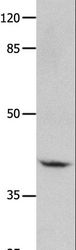 GNA11 Antibody - Western blot analysis of Human leiomyosarcoma tissue, using GNA11 Polyclonal Antibody at dilution of 1:450.