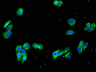GNA11 Antibody - Immunofluorescent analysis of HepG2 cells using GNA11 Antibody at a dilution of 1:100 and Alexa Fluor 488-congugated AffiniPure Goat Anti-Rabbit IgG(H+L)