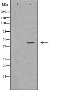 GNA11 Antibody - Western blot analysis of extracts of Leiomyosarcoma tissue using GNA11 antibody. The lane on the left is treated with the antigen-specific peptide.