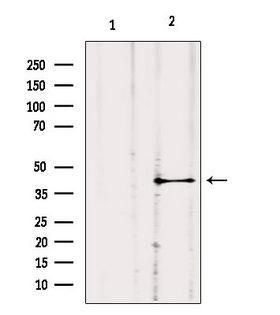 GNA11 Antibody - Western blot analysis of extracts of c476 using GNA11 antibody. Lane 1 was treated with the blocking peptide.