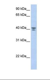 GNA12 Antibody - Fetal liver lysate. Antibody concentration: 1.0 ug/ml. Gel concentration: 12%.  This image was taken for the unconjugated form of this product. Other forms have not been tested.