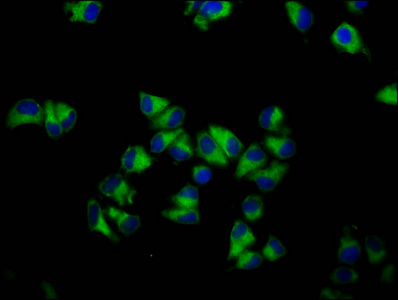 GNA12 Antibody - Immunofluorescence staining of Hela cells diluted at 1:133, counter-stained with DAPI. The cells were fixed in 4% formaldehyde, permeabilized using 0.2% Triton X-100 and blocked in 10% normal Goat Serum. The cells were then incubated with the antibody overnight at 4°C.The Secondary antibody was Alexa Fluor 488-congugated AffiniPure Goat Anti-Rabbit IgG (H+L).