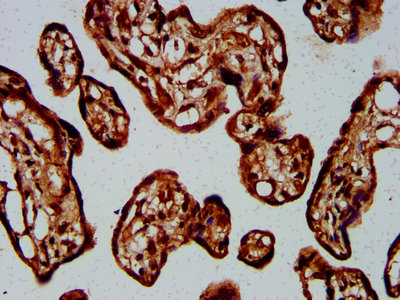 GNA12 Antibody - Immunohistochemistry Dilution at 1:400 and staining in paraffin-embedded human placenta tissue performed on a Leica BondTM system. After dewaxing and hydration, antigen retrieval was mediated by high pressure in a citrate buffer (pH 6.0). Section was blocked with 10% normal Goat serum 30min at RT. Then primary antibody (1% BSA) was incubated at 4°C overnight. The primary is detected by a biotinylated Secondary antibody and visualized using an HRP conjugated SP system.