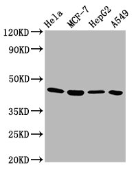 GNA12 Antibody - Western Blot Positive WB detected in: Hela whole cell lysate, MCF-7 whole cell lysate, HepG2 whole cell lysate, A549 whole cell lysate All Lanes: GNA12 antibody at 5.8µg/ml Secondary Goat polyclonal to rabbit IgG at 1/50000 dilution Predicted band size: 45, 38, 35 KDa Observed band size: 45 KDa