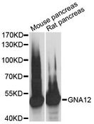 GNA12 Antibody - Western blot analysis of extracts of various cell lines, using GNA12 antibody at 1:3000 dilution. The secondary antibody used was an HRP Goat Anti-Rabbit IgG (H+L) at 1:10000 dilution. Lysates were loaded 25ug per lane and 3% nonfat dry milk in TBST was used for blocking. An ECL Kit was used for detection and the exposure time was 1s.