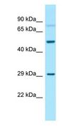 GNA13 Antibody - GNA13 antibody Western Blot of 721_B.  This image was taken for the unconjugated form of this product. Other forms have not been tested.
