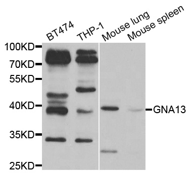 GNA13 Antibody - Western blot analysis of extracts of various cell lines.