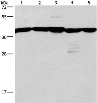 GNA13 Antibody - Western blot analysis of A172 and 293T cell, mouse kidney tissue, human testis and brain malignant glioma tissue, using GNA13 Polyclonal Antibody at dilution of 1:600.