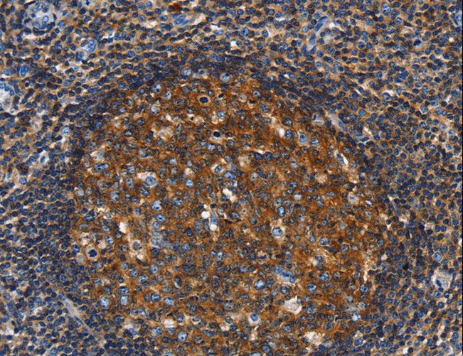 GNA13 Antibody - Immunohistochemistry of paraffin-embedded Human tonsil using GNA13 Polyclonal Antibody at dilution of 1:30.