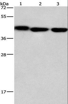 GNA13 Antibody - Western blot analysis of Mouse kidney tissue, human testis and brain malignant glioma tissue, using GNA13 Polyclonal Antibody at dilution of 1:450.