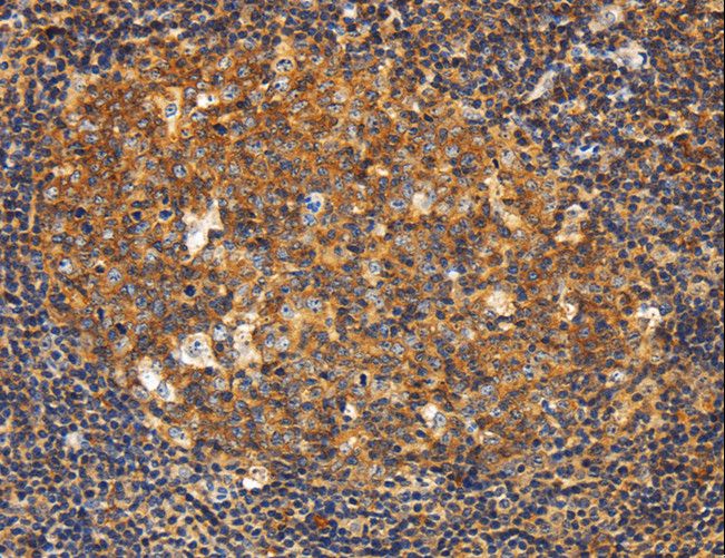 GNA13 Antibody - Immunohistochemistry of paraffin-embedded Human tonsil using GNA13 Polyclonal Antibody at dilution of 1:20.