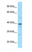 GNA14 Antibody - GNA14 antibody Western Blot of Human brain.  This image was taken for the unconjugated form of this product. Other forms have not been tested.