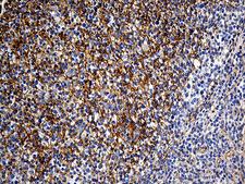 GNA14 Antibody - Immunohistochemical staining of paraffin-embedded Human tonsil within the normal limits using anti-GNA14 mouse monoclonal antibody. (Heat-induced epitope retrieval by 1mM EDTA in 10mM Tris buffer. (pH8.5) at 120°C for 3 min. (1:500)