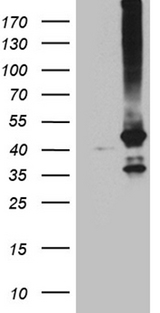 GNA14 Antibody - HEK293T cells were transfected with the pCMV6-ENTRY control. (Left lane) or pCMV6-ENTRY GNA14. (Right lane) cDNA for 48 hrs and lysed