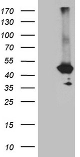 GNA14 Antibody - HEK293T cells were transfected with the pCMV6-ENTRY control. (Left lane) or pCMV6-ENTRY GNA14. (Right lane) cDNA for 48 hrs and lysed