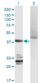 GNA14 Antibody - Western blot of GNA14 expression in transfected 293T cell line by GNA14 monoclonal antibody (M06), clone 2H8.