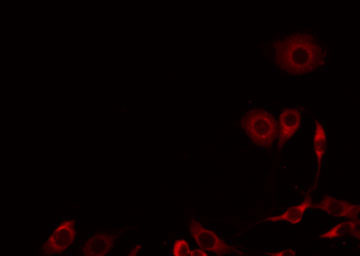 GNA14 Antibody - Staining HuvEc cells by IF/ICC. The samples were fixed with PFA and permeabilized in 0.1% Triton X-100, then blocked in 10% serum for 45 min at 25°C. The primary antibody was diluted at 1:200 and incubated with the sample for 1 hour at 37°C. An Alexa Fluor 594 conjugated goat anti-rabbit IgG (H+L) Ab, diluted at 1/600, was used as the secondary antibody.