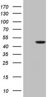 GNA15 Antibody - HEK293T cells were transfected with the pCMV6-ENTRY control (Left lane) or pCMV6-ENTRY GNA15 (Right lane) cDNA for 48 hrs and lysed. Equivalent amounts of cell lysates (5 ug per lane) were separated by SDS-PAGE and immunoblotted with anti-GNA15 (1:2000).