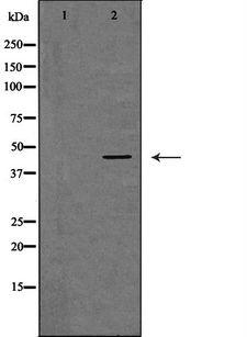 GNA15 Antibody - Western blot analysis of extracts of mouse heart tissue using GNA15 antibody. The lane on the left is treated with the antigen-specific peptide.