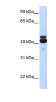 GNA15 Antibody - GNA15 antibody Western blot of Fetal Liver lysate. This image was taken for the unconjugated form of this product. Other forms have not been tested.