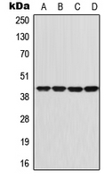 GNAI1 / Gi Antibody - Western blot analysis of GNAI1 expression in Jurkat (A); SHSY5Y (B); SP2/0 (C); PC12 (D) whole cell lysates.