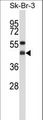 GNAI2 Antibody - GNAI2 Antibody western blot of SK-BR-3 cell line lysates (35 ug/lane). The GNAI2 antibody detected the GNAI2 protein (arrow).