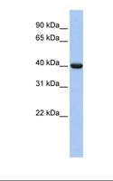 GNAI2 Antibody - Fetal lung lysate. Antibody concentration: 1.0 ug/ml. Gel concentration: 12%.  This image was taken for the unconjugated form of this product. Other forms have not been tested.