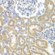 GNAI2 Antibody - Immunohistochemistry of paraffin-embedded rat kidney using GNAI2 antibody at dilution of 1:100 (40x lens).