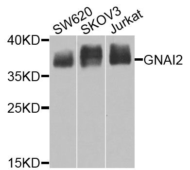GNAI2 Antibody - Western blot analysis of extracts of various cell lines, using GNAI2 antibody at 1:1000 dilution. The secondary antibody used was an HRP Goat Anti-Rabbit IgG (H+L) at 1:10000 dilution. Lysates were loaded 25ug per lane and 3% nonfat dry milk in TBST was used for blocking. An ECL Kit was used for detection and the exposure time was 10s.