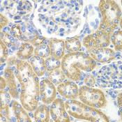 GNAI2 Antibody - Immunohistochemistry of paraffin-embedded Rat kidney using GNAI2 Polyclonal Antibody at dilution of 1:100 (40x lens).