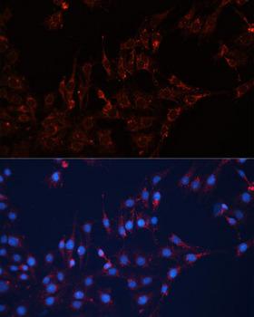 GNAI2 Antibody - Immunofluorescence analysis of C6 cells using GNAI2 Polyclonal Antibody at dilution of 1:100 (40x lens).Blue: DAPI for nuclear staining.