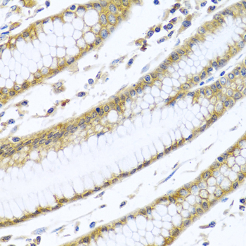 GNAI3 Antibody - Immunohistochemistry of paraffin-embedded human stomach using GNAI3 antibody at dilution of 1:100 (40x lens).