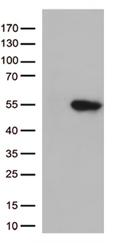 GNAL Antibody - HEK293T cells were transfected with the pCMV6-ENTRY control. (Left lane) or pCMV6-ENTRY GNAL. (Right lane) cDNA for 48 hrs and lysed. Equivalent amounts of cell lysates. (5 ug per lane) were separated by SDS-PAGE and immunoblotted with anti-GNAL. (1:500)