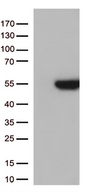 GNAL Antibody - HEK293T cells were transfected with the pCMV6-ENTRY control. (Left lane) or pCMV6-ENTRY GNAL. (Right lane) cDNA for 48 hrs and lysed. Equivalent amounts of cell lysates. (5 ug per lane) were separated by SDS-PAGE and immunoblotted with anti-GNAL. (1:500)