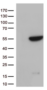 GNAL Antibody - HEK293T cells were transfected with the pCMV6-ENTRY control. (Left lane) or pCMV6-ENTRY GNAL. (Right lane) cDNA for 48 hrs and lysed. Equivalent amounts of cell lysates. (5 ug per lane) were separated by SDS-PAGE and immunoblotted with anti-GNAL. (1:500)