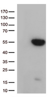 GNAL Antibody - HEK293T cells were transfected with the pCMV6-ENTRY control. (Left lane) or pCMV6-ENTRY GNAL. (Right lane) cDNA for 48 hrs and lysed. Equivalent amounts of cell lysates. (5 ug per lane) were separated by SDS-PAGE and immunoblotted with anti-GNAL. (1:500)
