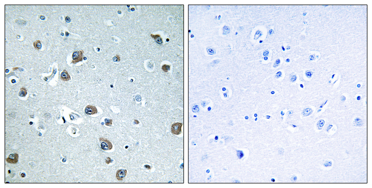 GNAL Antibody - Immunohistochemistry analysis of paraffin-embedded human brain tissue, using GNAL Antibody. The picture on the right is blocked with the synthesized peptide.