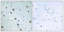 GNAL Antibody - Immunohistochemistry analysis of paraffin-embedded human brain tissue, using GNAL Antibody. The picture on the right is blocked with the synthesized peptide.