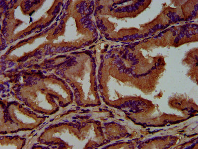 GNAL Antibody - Immunohistochemistry Dilution at 1:500 and staining in paraffin-embedded human prostate tissue performed on a Leica BondTM system. After dewaxing and hydration, antigen retrieval was mediated by high pressure in a citrate buffer (pH 6.0). Section was blocked with 10% normal Goat serum 30min at RT. Then primary antibody (1% BSA) was incubated at 4°C overnight. The primary is detected by a biotinylated Secondary antibody and visualized using an HRP conjugated SP system.